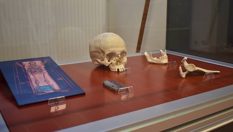 Svatojánské muzeum v Nepomuku vystavuje i odlitek lebky Jana Nepomuckého, kde je vidět poškození obličejové části způsobené mučením.
