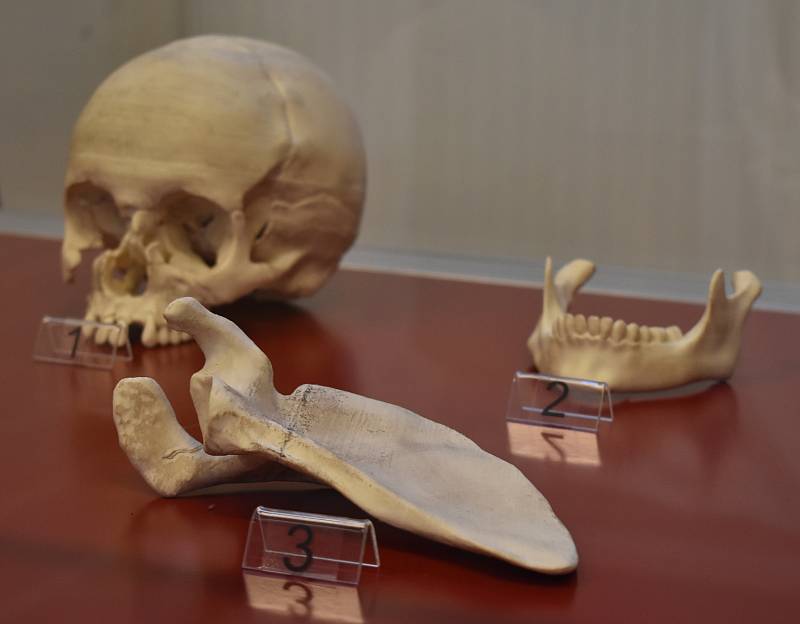 Svatojánské muzeum v Nepomuku vystavuje i odlitek lebky Jana Nepomuckého, kde je vidět poškození obličejové části způsobené mučením.