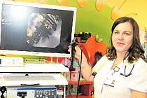 Odborníci Dětské kliniky FN Plzeň vyšetřují nejmenší děti, kojence a batolata novým ultratenkým videobronchoskopem, který dokumentuje nález formou videozáznamu. Na snímku lékařka Dětské kliniky FN Plzeň Marcela Kreslová.