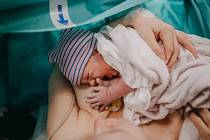 V rakovnické porodnici otevřeli nové Centrum pro porod císařským řezem.