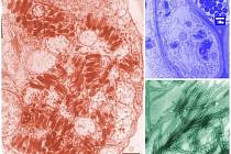 Ilustrační snímky virů z elektronového mikroskopu, kolorováno.