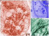 Ilustrační snímky virů z elektronového mikroskopu, kolorováno.