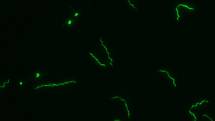 Na snímcích pokusná klíšťata v laboratorním chovu Biologického centra AV ČR České Budějovice.