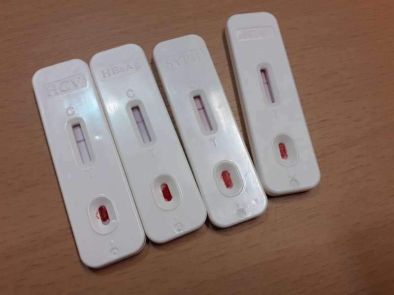 Českobudějovické Kontaktní centrum Prevent 99 nabízí bezplatné a anonymní testování na HIV, syfilis a žloutenku typu B a C nejen v rámci mezinárodní kampaně Evropského týdne testování na HIV a žloutenku.