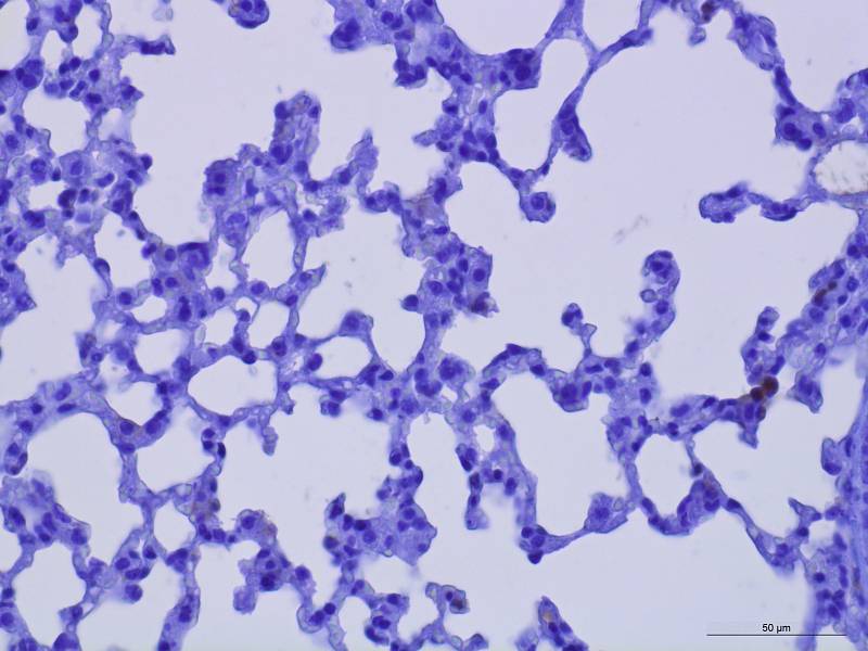Plicní tkáň. Mikrofotografie (zvětšení 400x) plicních tkání myší 8 dní po infekci SARS-Cov-2. V plicích byly zvýrazněny makrofágy (buňky imunitního systému) – hnědě nabarvené buňky. Na obrázku 1 je tkáň po použití bispecifické protilátky.