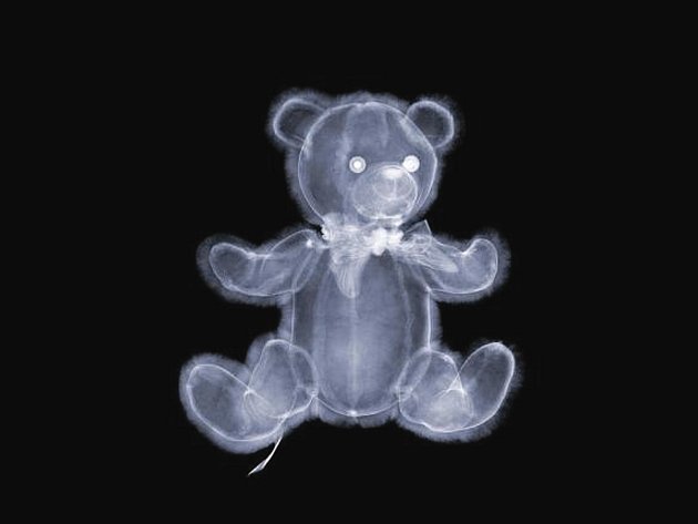 Nick Veasey fotografuje pomocí rentgenu, jehož paprsky pronikají pod povrch každodenních věcí.