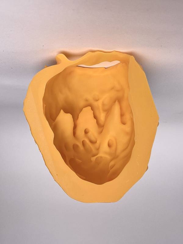 Ve Fakultní nemocnici Brno jsou nově schopni na 3D tiskárně vytisknout dokonalý model takového srdce a rozhodnout o nejvhodnějším postupu při operaci.