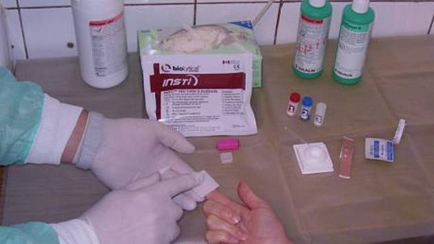 V KOTCI se mohli zájemci podrobit testům na virus HIV a žloutenky v krvi. 