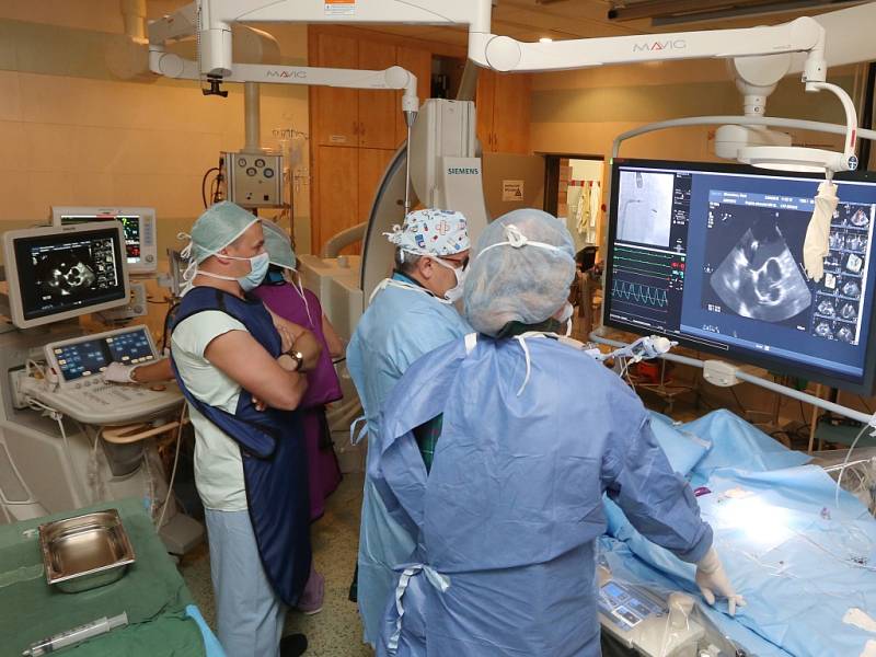 Novou metodu katetrizační operace nedomykavé srdeční chlopně zavádějí na Kardiologické klinice Masarykovy nemocnice.