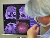 NOVINKA umožní vyšetření mozku pacienta během rekordně krátké doby přímo na lůžku bez převozu na další oddělení. 