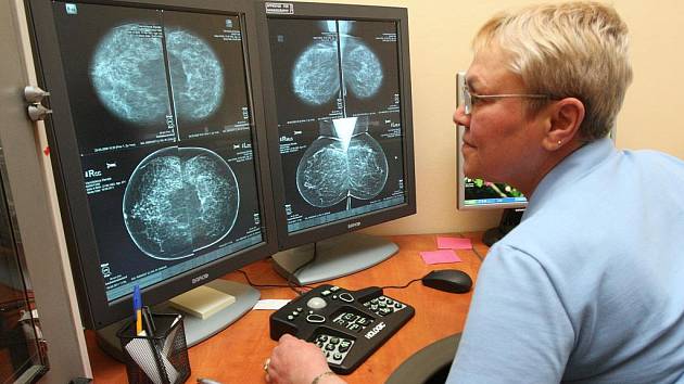 Digitální mamograf šetří prsa pacientek a čas lékařů.