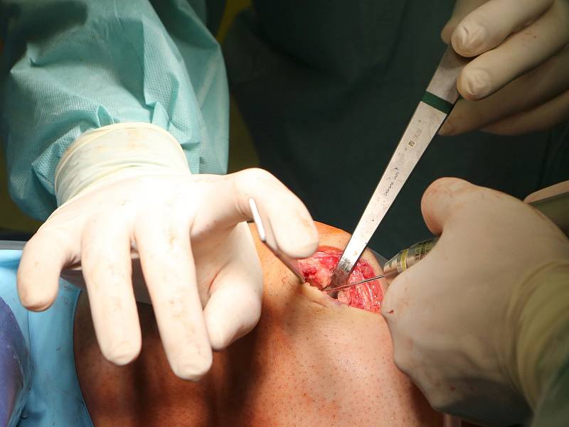 Unikátní ortopedické operace kolen provádí v Masarykově nemocnici v Ústí nad Labem ortoped MUDr. Pavel Neckář.