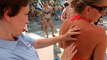 Návštěvníci koupaliště v Brné si mohli nechat zkontrolovat znaménka na kůži, kvůli melanomu.