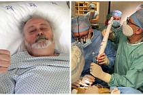Lékaři nahradili srdeční chlopeň Lubomíra Časára šetrnější metodou.