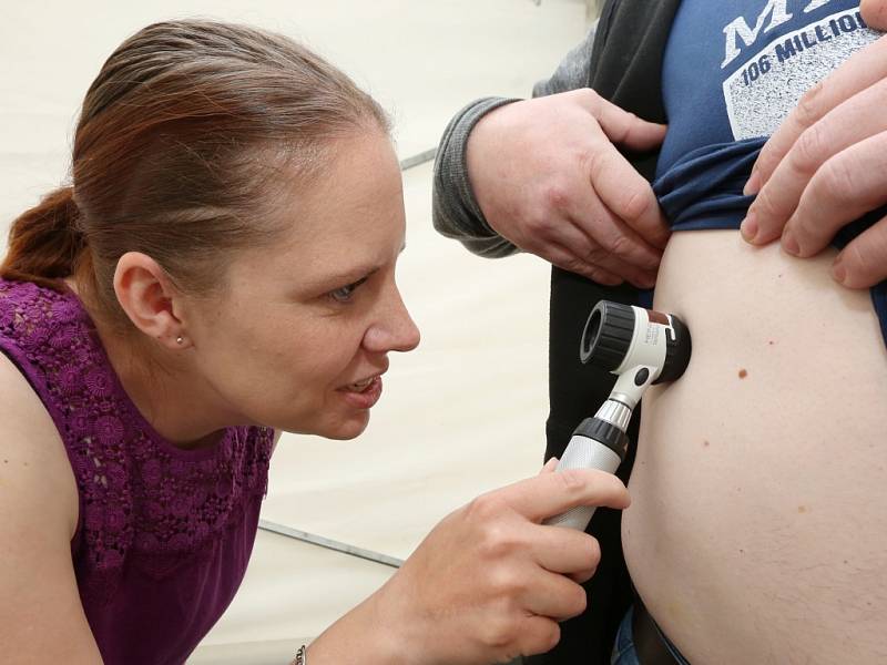 Akce Spolu proti melanomu v Ústí nad Labem.