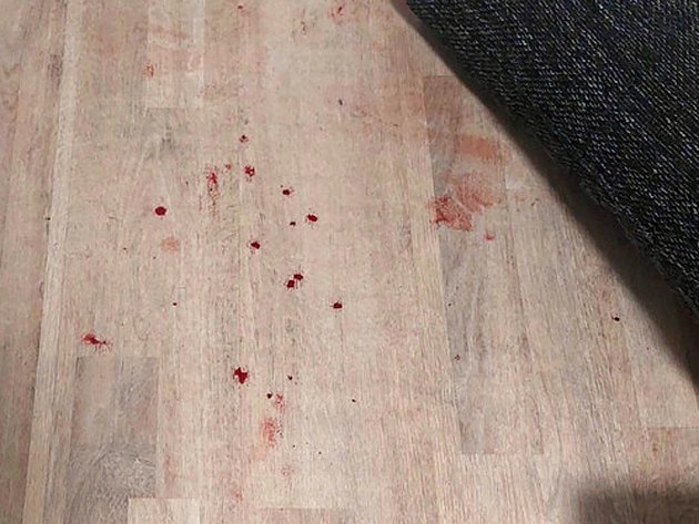 Strážníci MP Zlín zasahovali počátkem listopadu 2023 u několika násilných incidentů. Tekla při nich i krev.