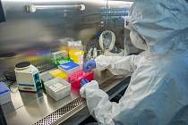 Ve zlínské Krajské nemocnici Tomáše Bati začali v laboratoři testovat vzorky odebrané lidem s podezřením na nákazu novým typem koronaviru.