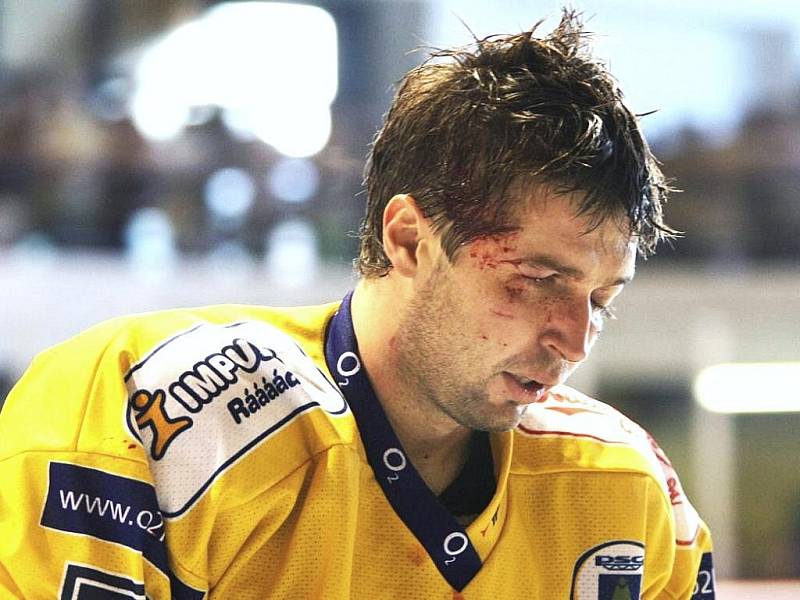 Start hokejisty Jaroslava Balaštíka v začátku hokejové extraligy je po zranění nejistý. 
