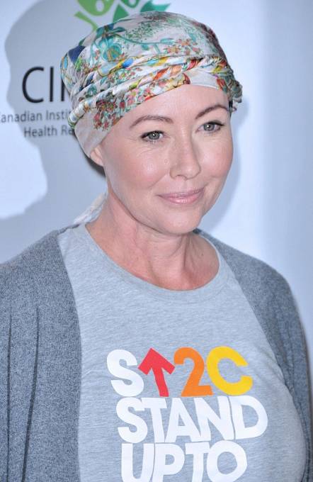 Shannen Doherty kvůli rakovině oholila hlavu.