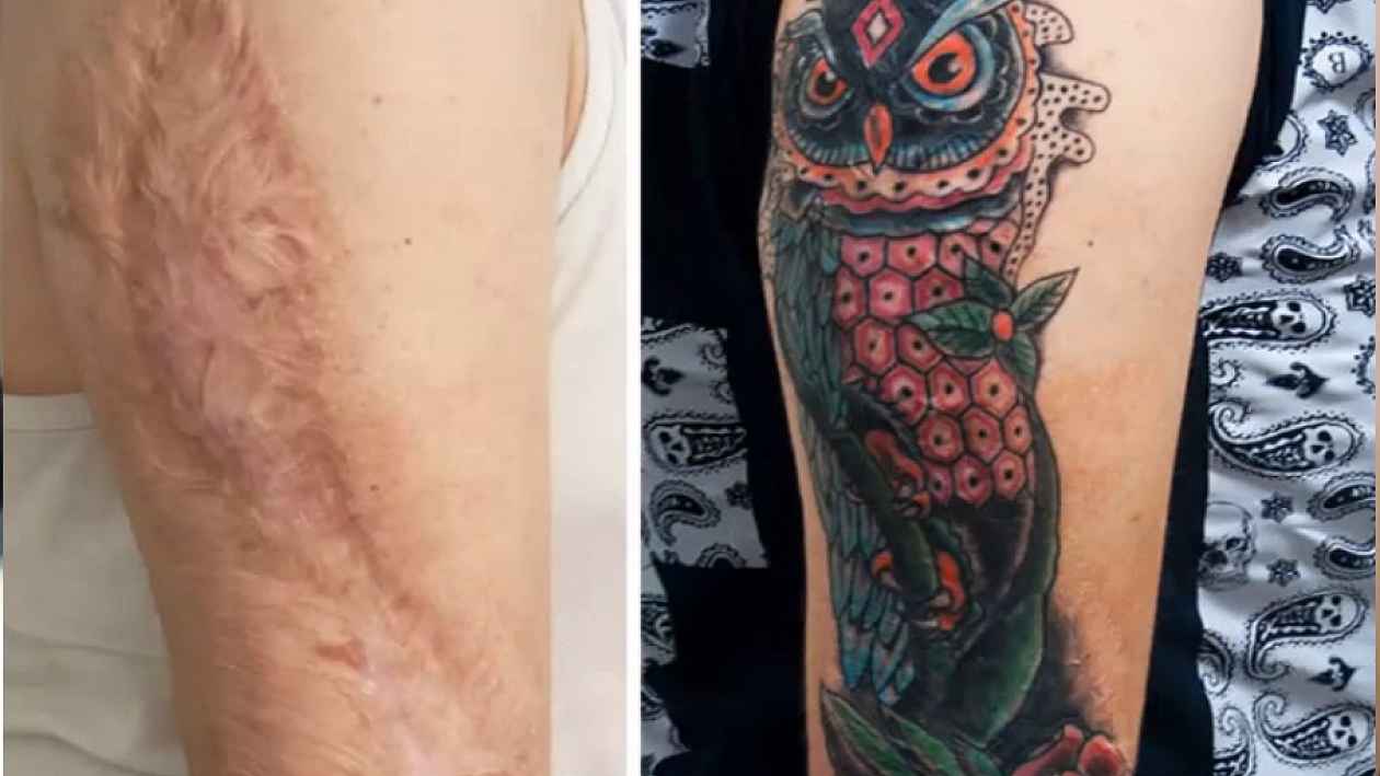 ZJIZVENÁ KRÁSA. Když se zranění stane PŘEDNOSTÍ. 27 jizev VYUŽITÝCH při  tetování - Šíp