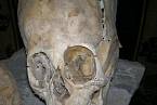 Výrazné oční důlky, stoličky a švy. Bizarní lebka z Andahuaylillas.