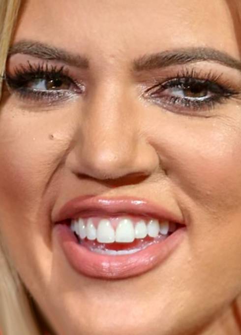 Khloe Kardashian je tak trochu zrůdička.