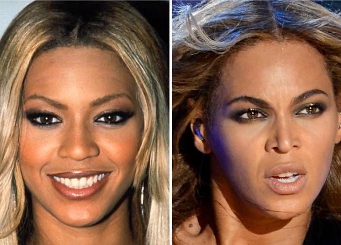 Beyoncé má falešné leccos. Včetně nosu.