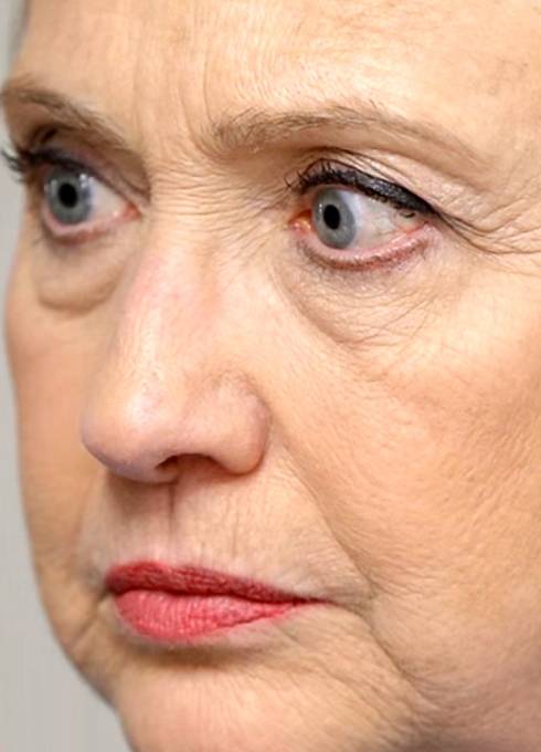 Hilary Clinton a její krátery v obličeji.