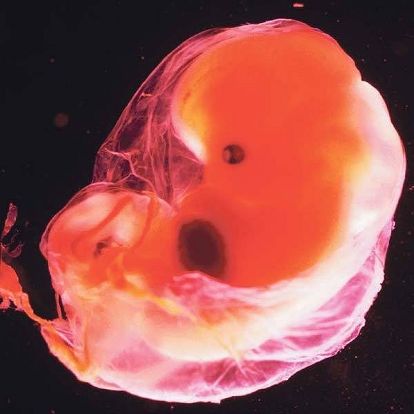 Lidské embryo v 15. týdnu těhotenství