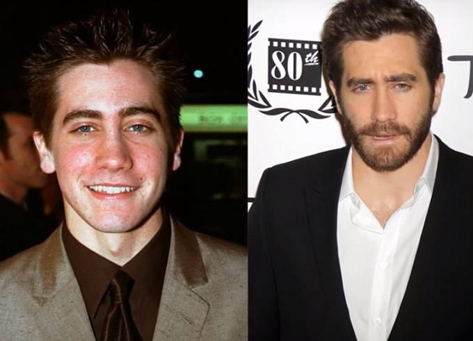 Jake Gyllenhaal si nechal upravit nos.