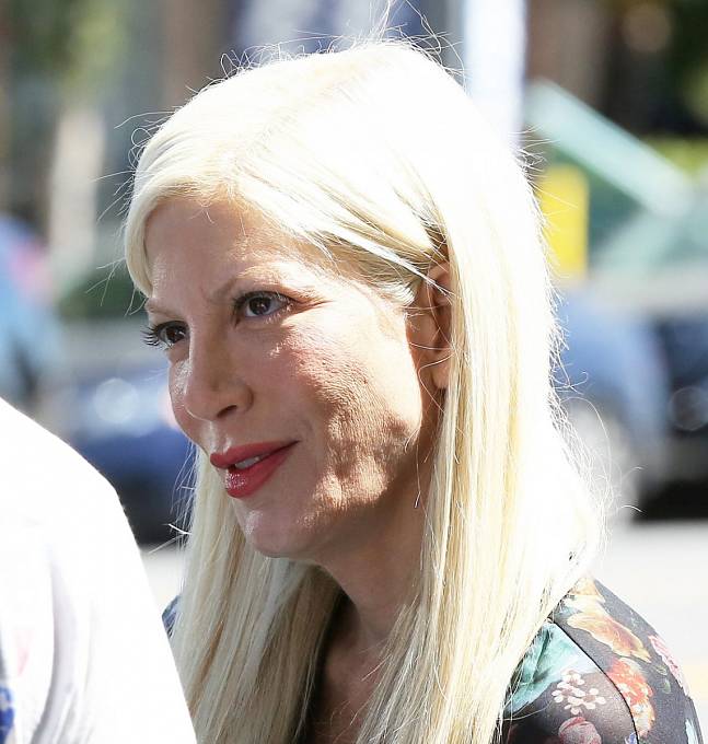 Tori Spelling má docela problémy s velkými póry.