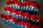 Laboratoře AGELLAB, které jako první soukromé laboratoře v republice obdržely od Státního zdravotního ústavu povolení testovat přítomnost koronaviru. Denně zde vyšetří až 250 vzorků.
