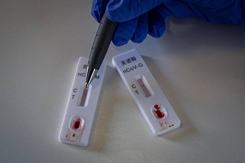 Plošné testování protilátek proti SARS-CoV-2 (COVID-19) v Moravskoslezském kraji, 2. května 2020 v Ostravě. Rychlotesty.