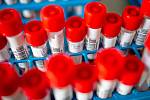 Laboratoře AGELLAB, které jako první soukromé laboratoře v republice obdržely od Státního zdravotního ústavu povolení testovat přítomnost koronaviru.