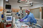 Oddělení resuscitační a intenzivní medicíny (ORIM 3) ve Fakultní nemocnic Ostrava (FNO), 7. října 2020 v Ostravě. Oddělení ORIM 3 je vyhrazeno pro pacienty s onemocnění koronavirem (COVID-19). Staniční sestra Tomáš Glac se stará o pacienta.