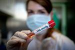 Laboratoře AGELLAB, které jako první soukromé laboratoře v republice obdržely od Státního zdravotního ústavu povolení testovat přítomnost koronaviru. Denně zde vyšetří až 250 vzorků.