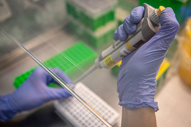 Testování vzorků koronaviru v laboratoři AGELLAB ve Vítkovické nemocnici v Ostravě, říjen 2020. Ilustrační foto.