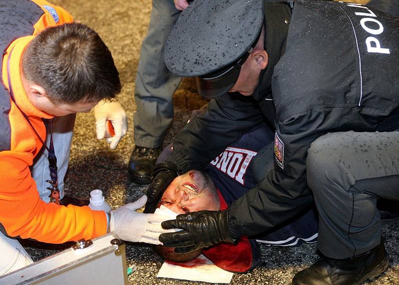 Zraněný fanoušek, který napadl jednoho z policistů.