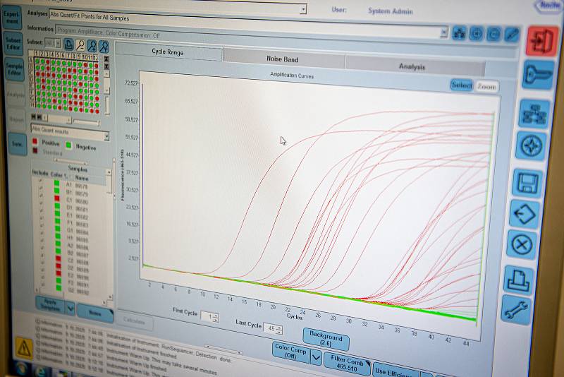 Testování vzorků koronaviru v laboratoři AGELLAB ve Vítkovické nemocnici v Ostravě, říjen 2020. Ilustrační foto.