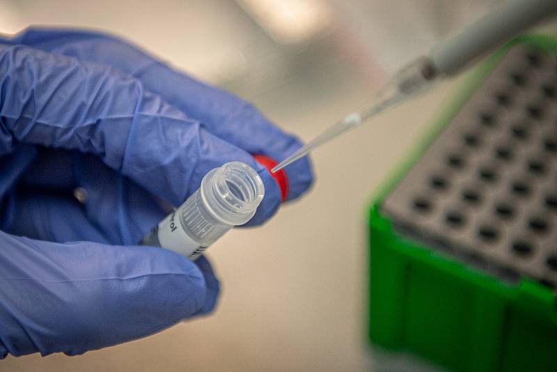 Testování vzorků koronaviru v laboratoři AGELLAB ve Vítkovické nemocnici v Ostravě. Ilustrační foto.