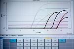Laboratoře AGELLAB, které jako první soukromé laboratoře v republice obdržely od Státního zdravotního ústavu povolení testovat přítomnost koronaviru. Denně zde vyšetří až 250 vzorků.