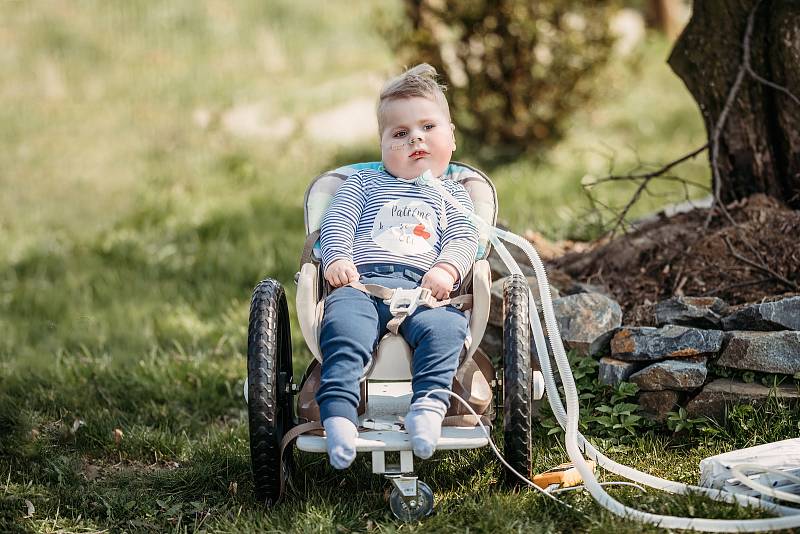 OLÍK ze Sedlnice, pruhovaná trička jsou symbolem sbírky na jeho léčbu.