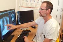 Lékaři Nemocnice Šumperk úspěšně testují umělou inteligenci pro čtení rentgenových snímků. Na fotografii primář RDG oddělení Jiří Gerold.