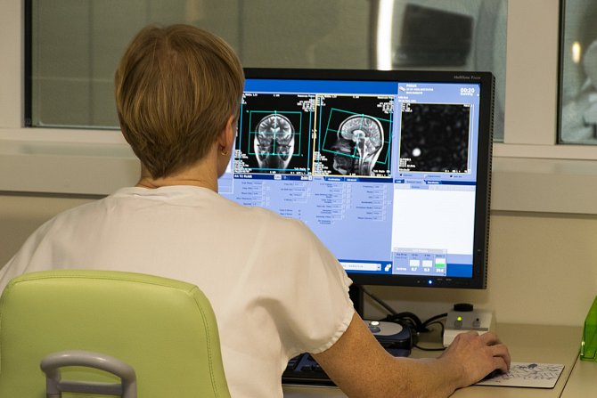 Přerovská nemocnice se zaměří na osvětu mozkové mrtvice