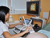 Nový ultrazvuk mohou od těchto dnů v Uherskohradišťské nemocnici využívat všechny nastávající matky. 