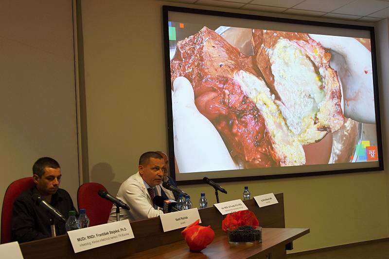 Rizika spojená s nákazou echinokokózou představili v pátek odborníci v Institutu klinické a experimentální medicíny.