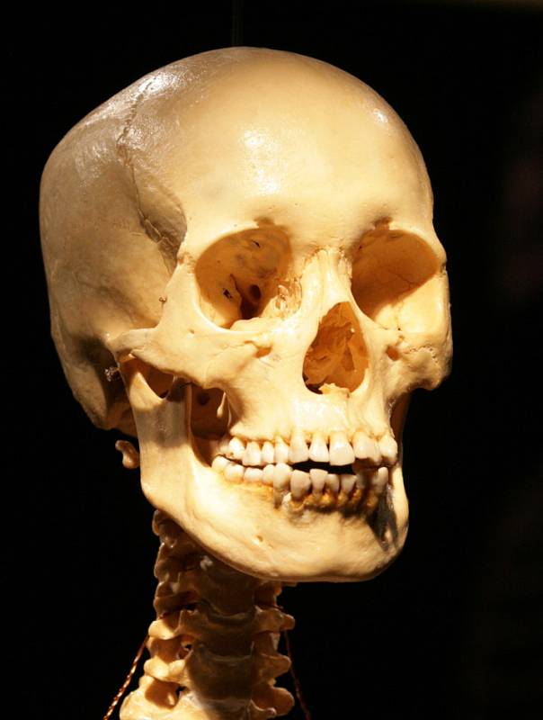 V Křižíkově pavilonu na Výstavišti začala výstava exponátů připravených z lidských těl.