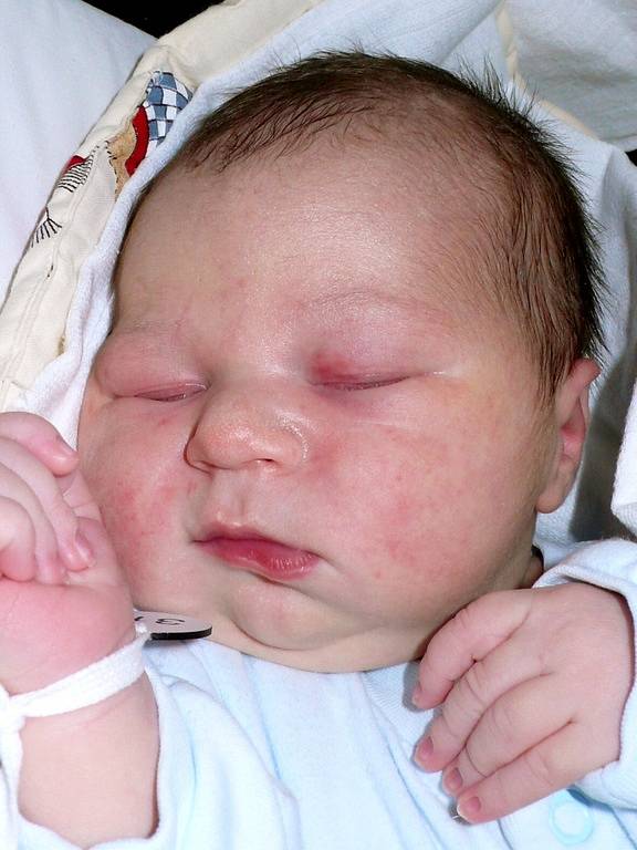 Nikolas Mlynařík, 25. 3. 2009, 53 cm, 4340 g,  VFN, U Apolináře