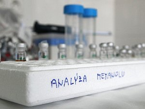 Analýza metanolu. Ilustrační foto. 