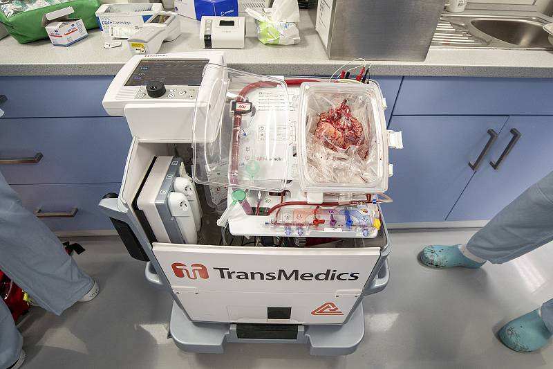 IKEM poprvé použil metodu tzv. převozu bijícího srdce k transplantaci mezi dvěma státy. V Česku tak nový orgán zachránil život malému dítěti.